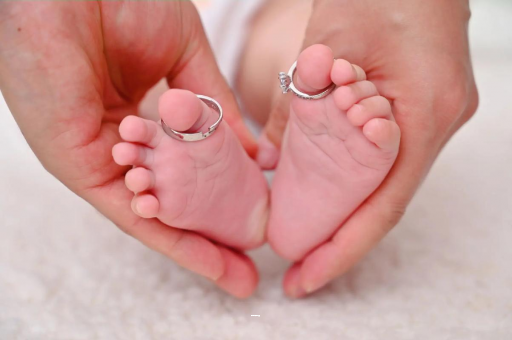 桂阳孕妇怎样预防妊娠纹